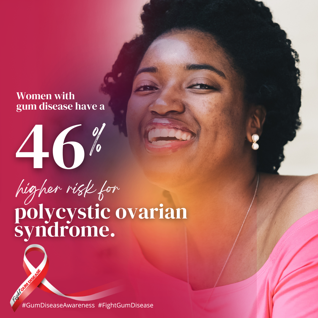 Oral systemic connection between gum disease and polycystic ovarian syndrome. Women with gum disease have a 46% higher risk for polycystic ovarian syndrome.