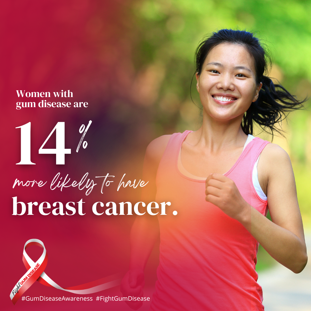 Oral systemic connection between gum disease and breast cancer. Women with gum disease are 14% more likely to have breast cancer.