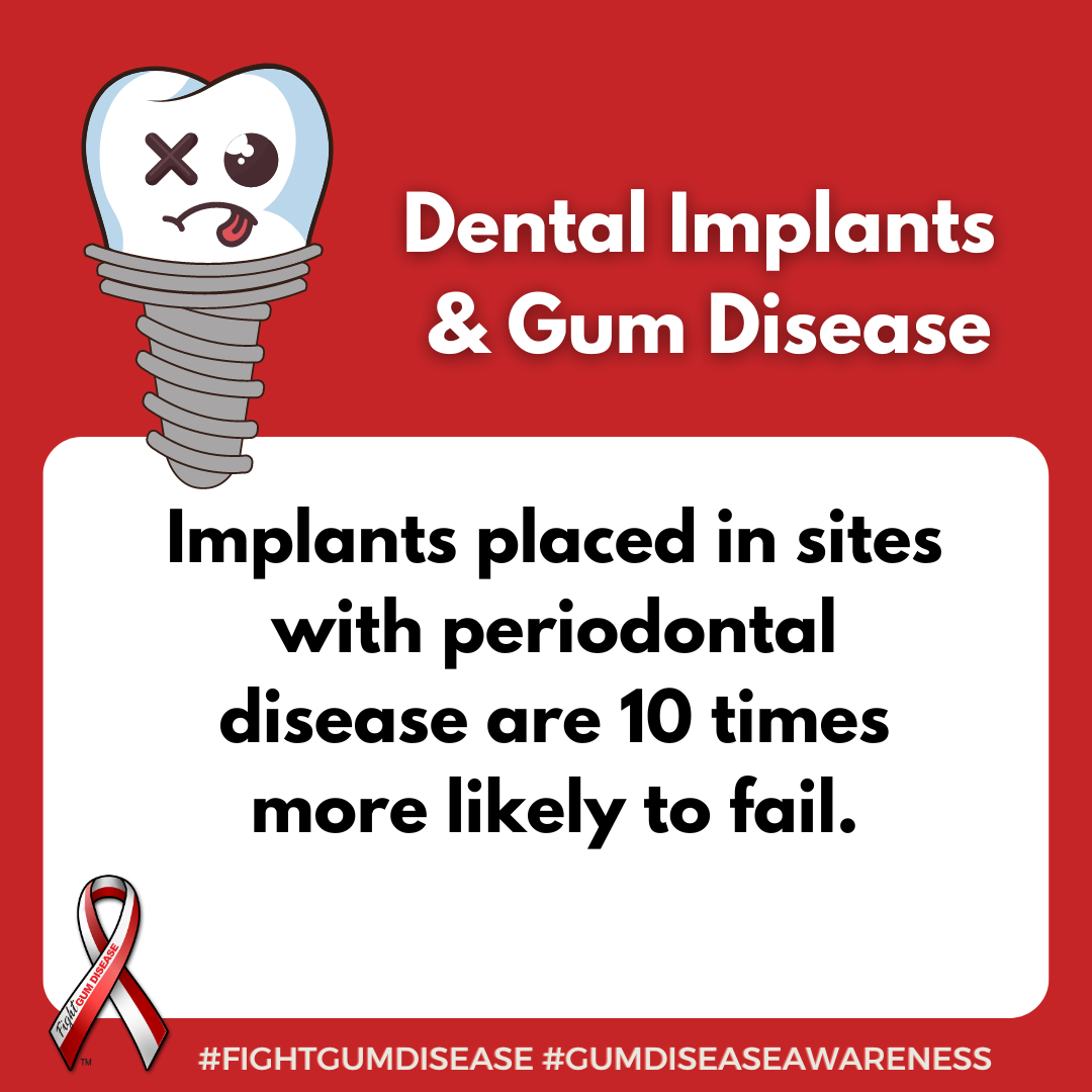 Implants placed in sites with periodontal disease are 10 times more likely to fail. Fight Gum Disease and increase Gum Disease Awareness.