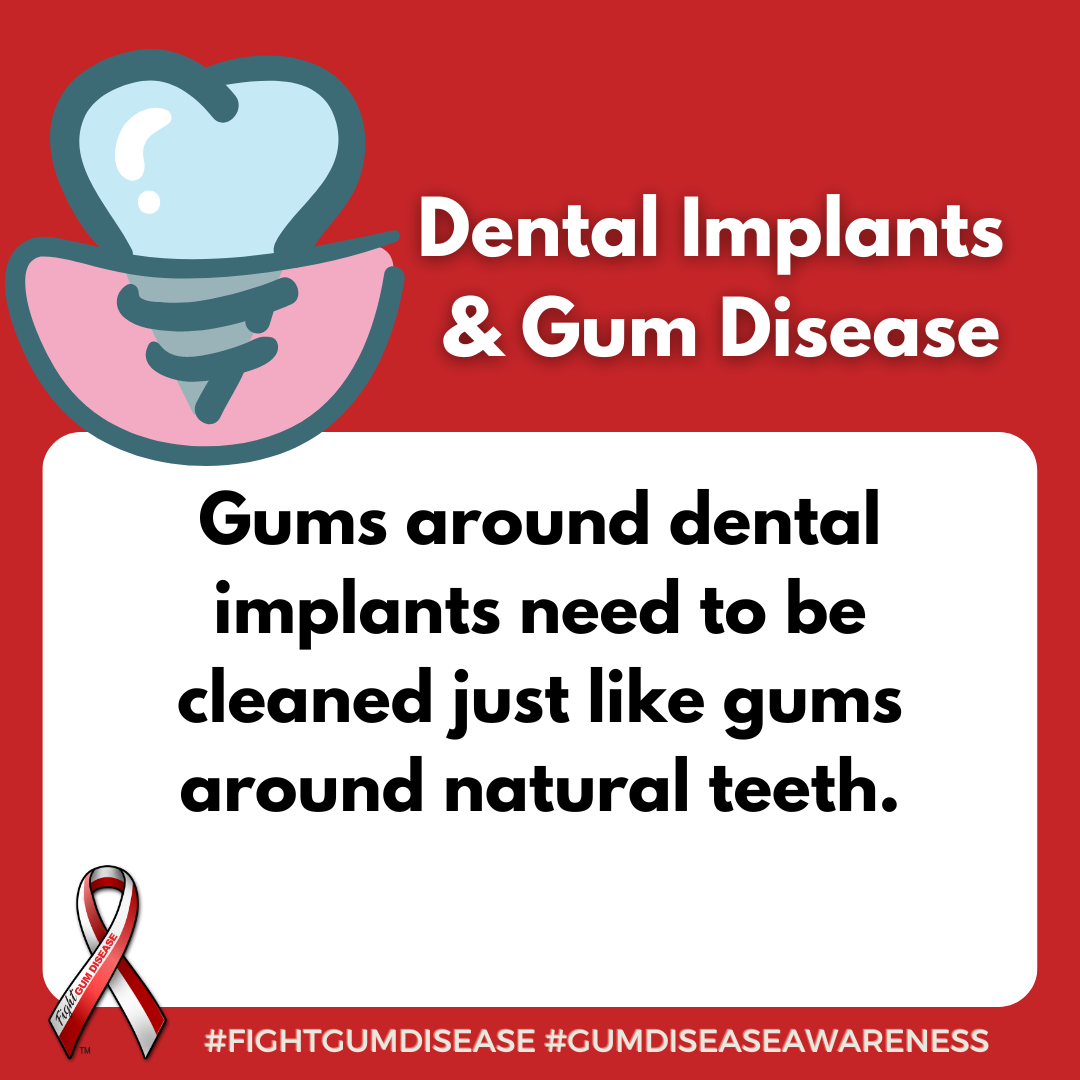 Gums around dental implants need to be cleaned just like gums around natural teeth. Fight Gum Disease and increase Gum Disease Awareness.