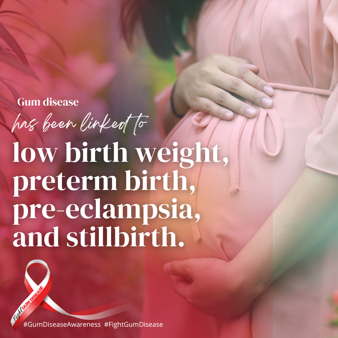 Oral systemic connection between gum disease and pregnancy. Pregnant women with gum disease are more likely to have a low birth weight child, pre-eclampsia, pre-term birth and still birth.
