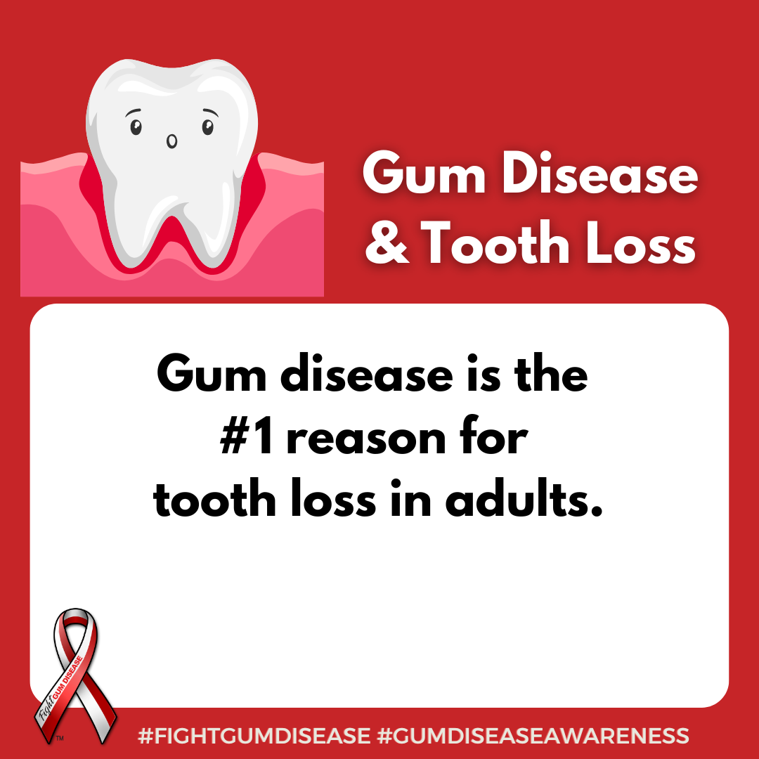 Gum disease is the #1 reason for tooth loss in adults. Fight Gum Disease and increase Gum Disease Awareness.